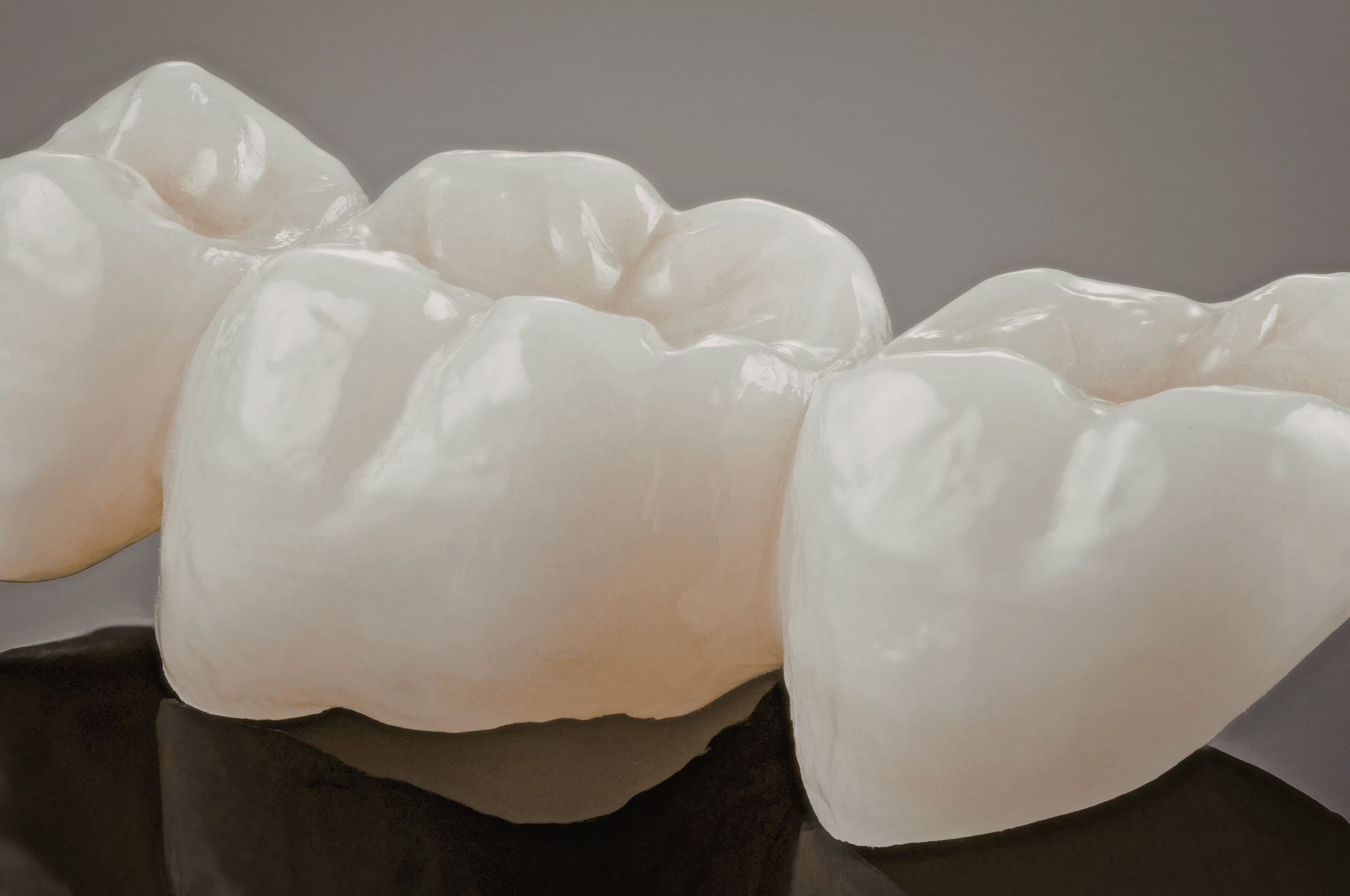 dental-crown-in-burlington-ontario-