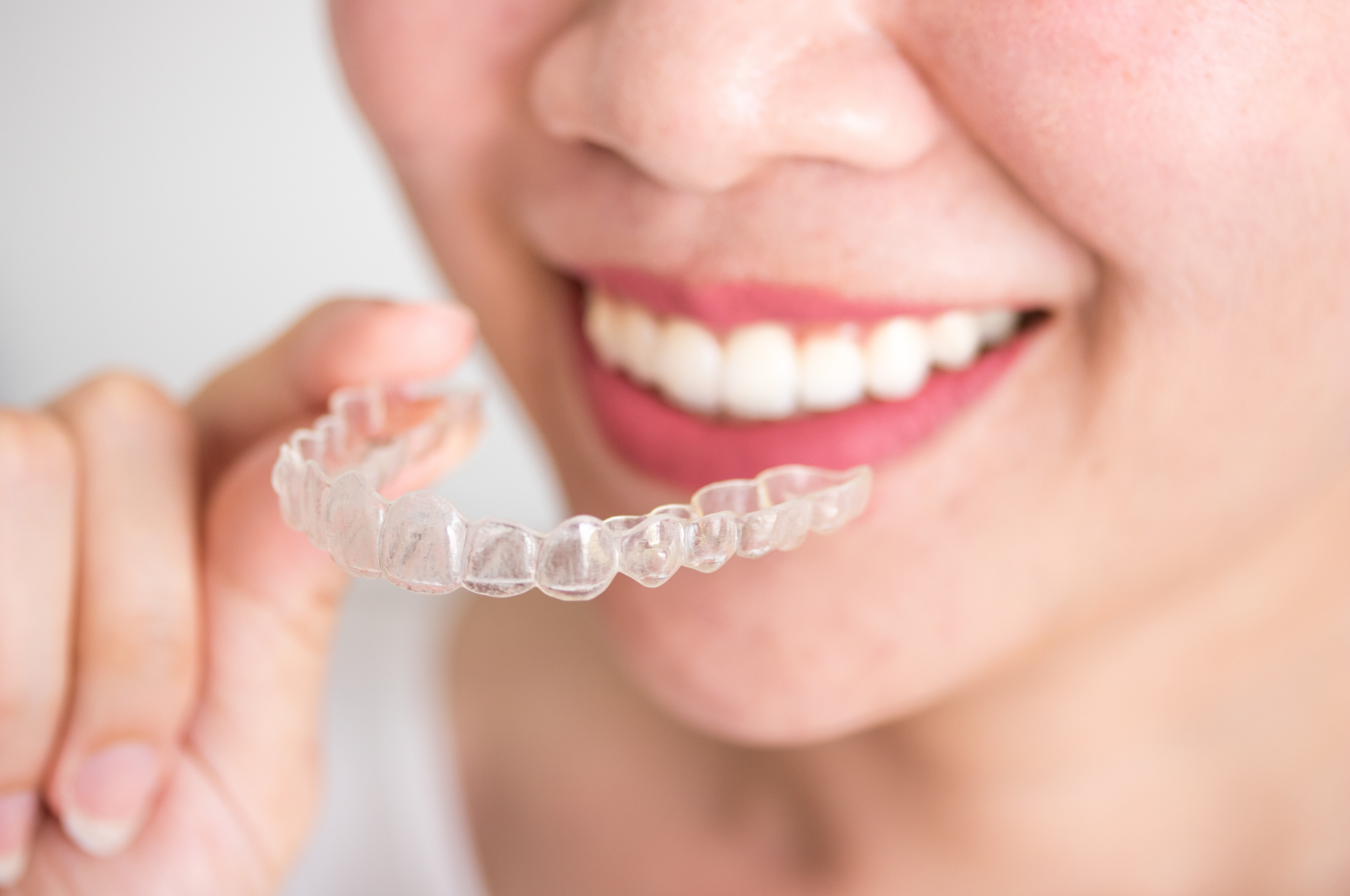 invisalign-burlington