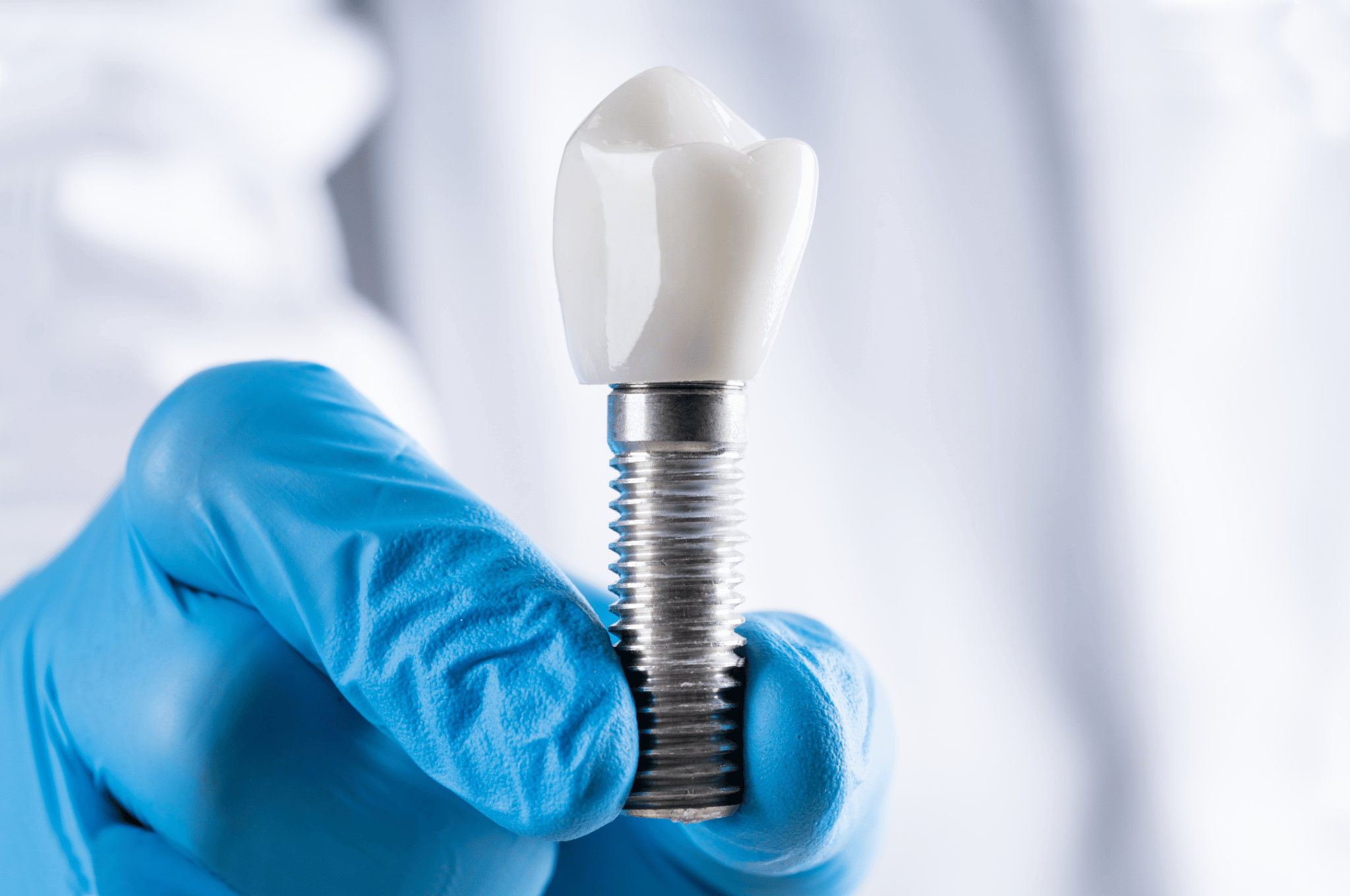 single-tooth-implants-in-burlington-on