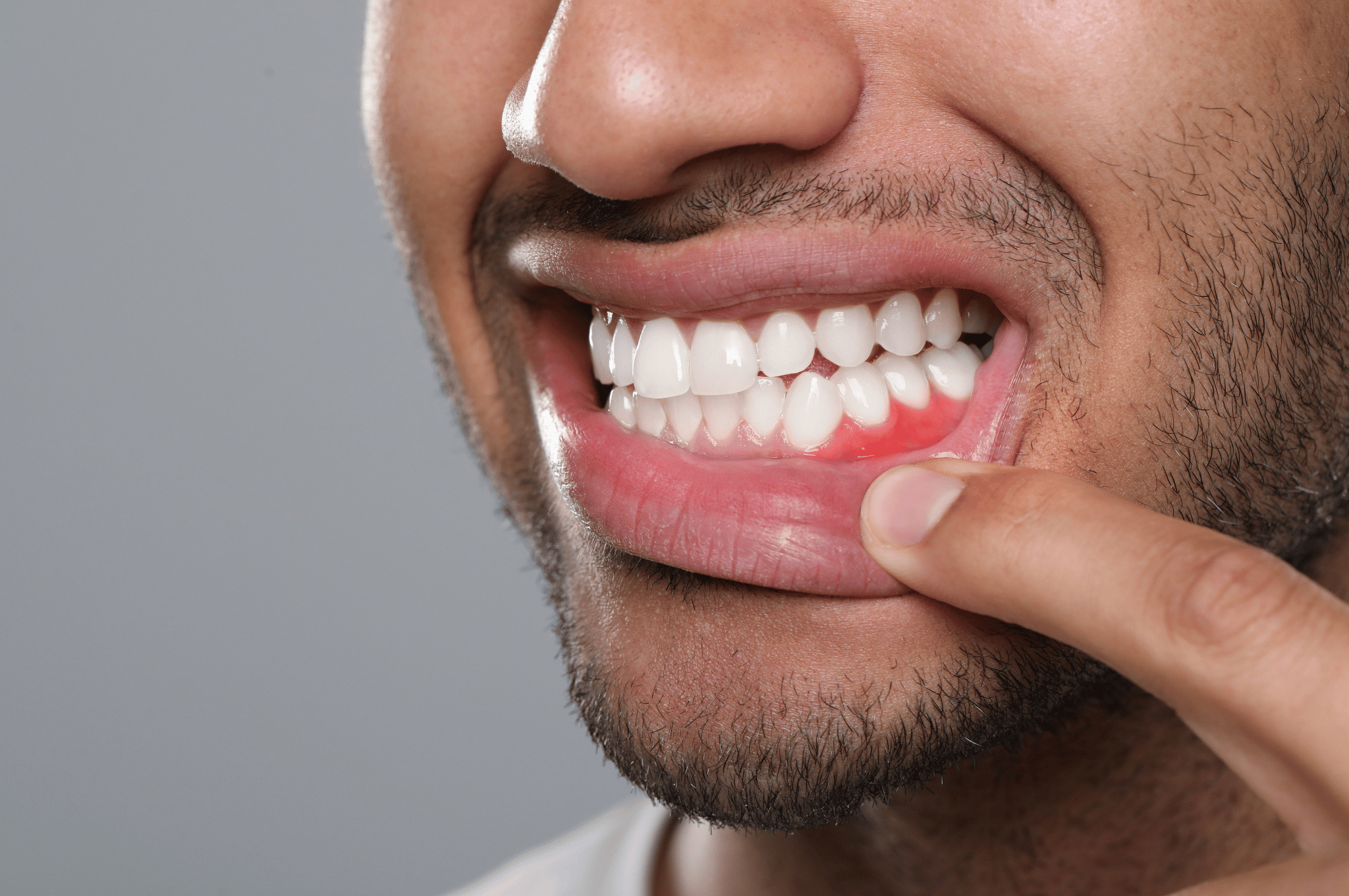Signs and Symptoms of Gum Disease