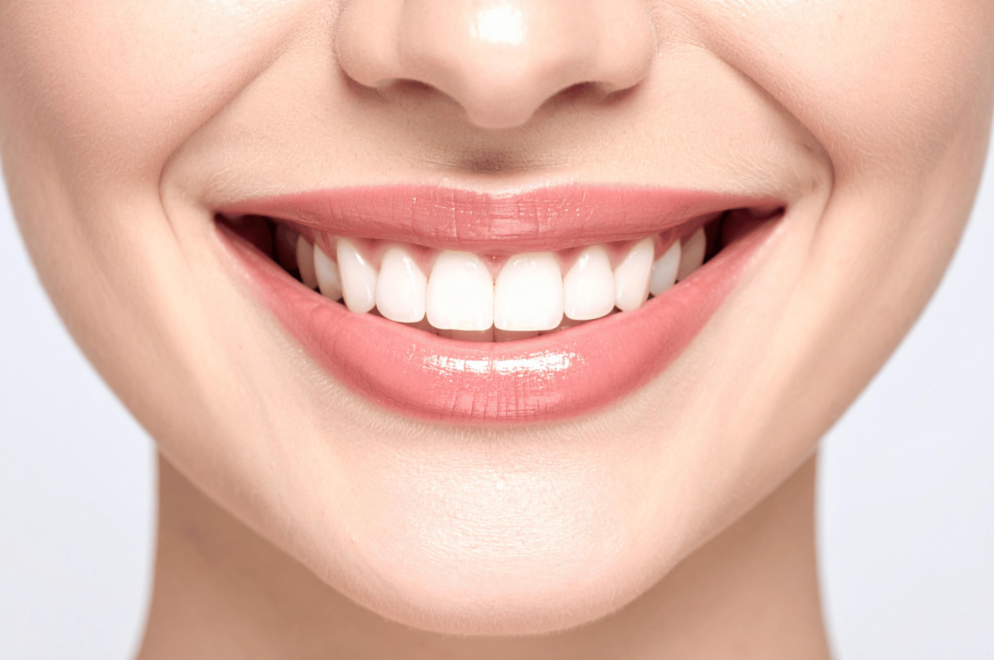 veneers-in-burlington-by-white-rose-dental-studio