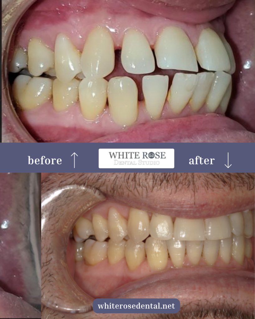 white-rose-dental---dentist-in-burlington-1