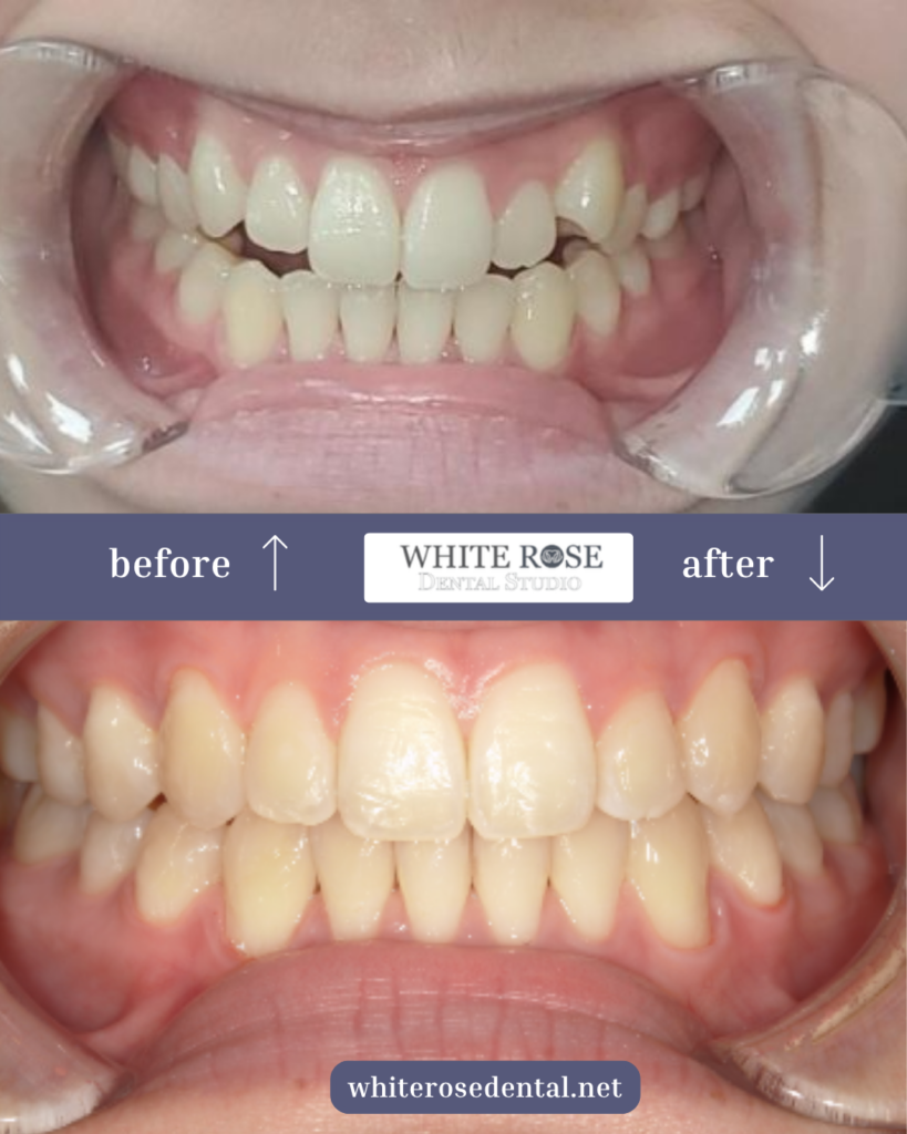 white-rose-dental---dentist-in-burlington-11