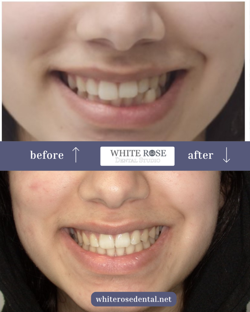 white-rose-dental---dentist-in-burlington-12