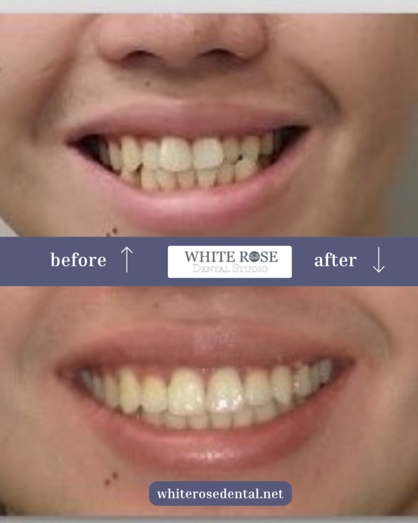 white-rose-dental---dentist-in-burlington-13