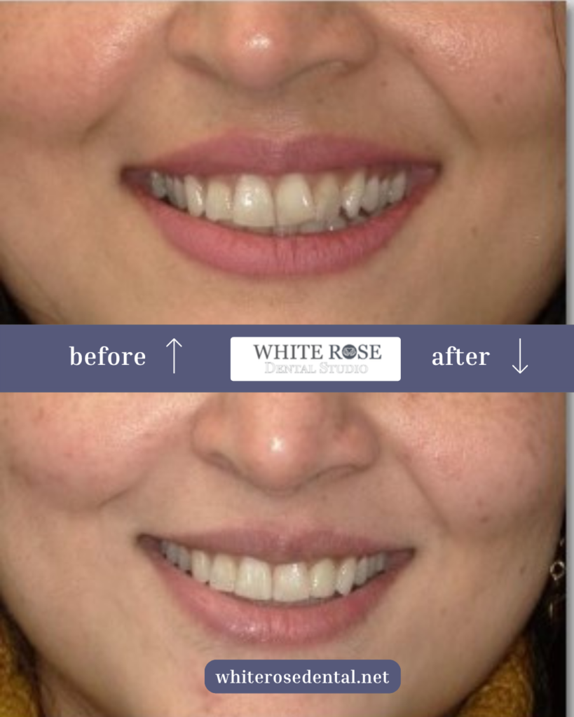white-rose-dental---dentist-in-burlington-14