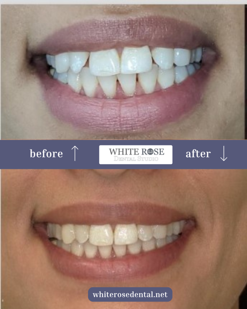white-rose-dental---dentist-in-burlington-15