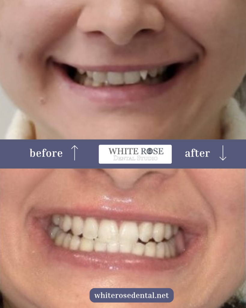 white-rose-dental---dentist-in-burlington-8