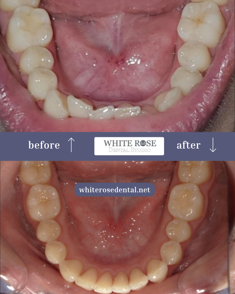 white-rose-dental---dentist-in-burlington-9