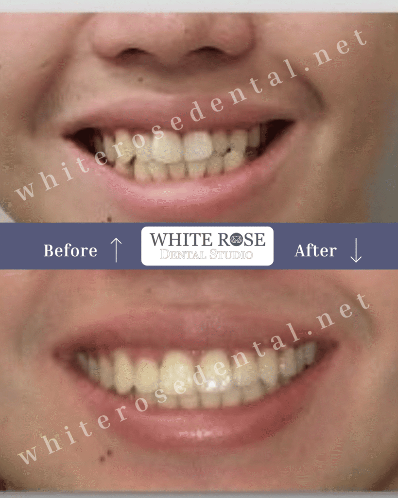 cosmetic-dentist-smile-transformation-13