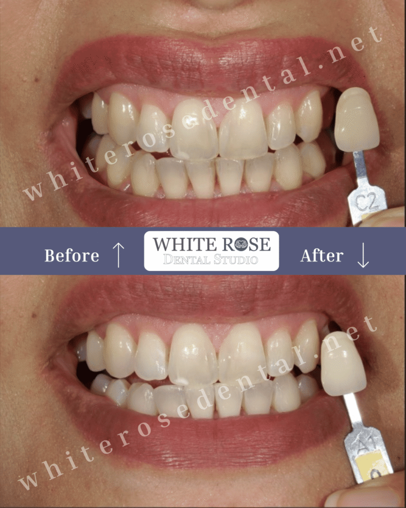 cosmetic-dentistry-burlington-23