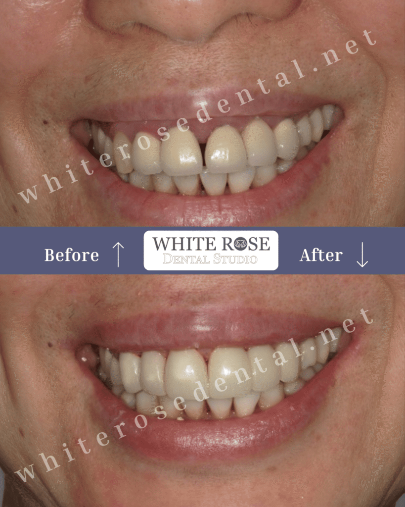 cosmetic-destist-before-and-after-19