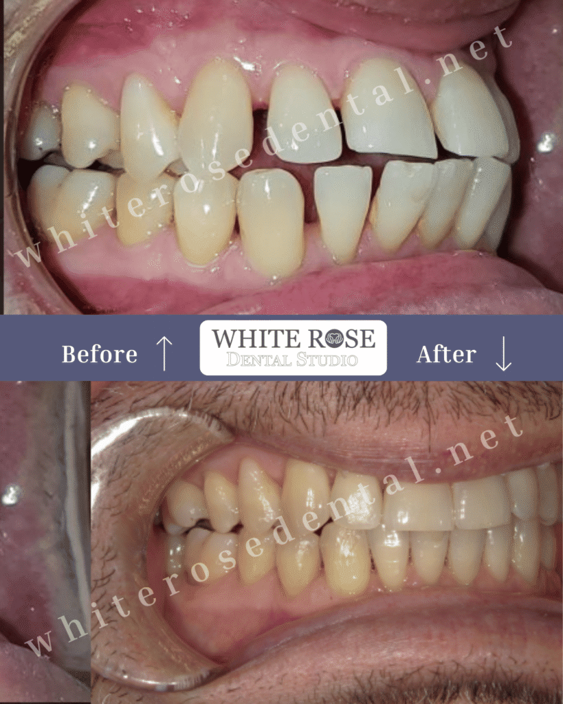 Hi Dr. Ali, hope you are doing well and excited about the upcoming clinic opening! As Burlington Dental Studio prepares for its big launch, I wanted to share an exciting update — your new website is now complete and our team is actively working on the full digital marketing setup to make sure everything is ready to drive new patients to your clinic from day one! 🌟 Your New Website is Live — Please Take a Look! 👉 https://burlingtondentalstudio.ca/ Your new website has been fully optimized for all devices: • 📱 Mobile — looks and performs perfectly on all smartphones • 📲 Tablet — fully responsive and easy to navigate on all tablet screens • 💻 Desktop — clean, professional, and conversion-focused on all desktop browsers Please take a moment to review the website on all your devices and let me know if you would like any changes or adjustments before we launch your marketing campaigns! Here is a full breakdown of everything we are currently working on for you: 🌐 Website & SEO Optimization Your brand new Burlington Dental Studio website is live and we are now optimizing every page for Google Search, local SEO, and AI-powered search platforms. This ensures that when new patients in Burlington search for a dentist, your clinic appears at the top of the results! 📢 Google Ads Campaign Setup We are building and preparing your Google Ads campaigns so they are ready to launch the moment Burlington Dental Studio opens its doors. Our goal is to drive new patient calls and inquiries from day one of your opening! 🤖 AI Search Optimization We are optimizing your online presence so that AI platforms like ChatGPT, Google Gemini, and Perplexity can find, understand, and recommend Burlington Dental Studio when patients ask questions like “Who is the best dentist in Burlington?” or “Which dental clinic is accepting new patients near me?” 📝 Website Blog Content Research Our team is researching and preparing SEO-optimized blog content specifically tailored for Burlington Dental Studio. These blog articles will help drive organic traffic to your website and strengthen your Google search rankings over time. 📱 Custom Social Media Layout Design We are creating fully custom branded social media post designs for Burlington Dental Studio across Facebook, Instagram, and Google My Business — ensuring your clinic looks professional, consistent, and eye-catching across all platforms from day one! 📍 Google Business Profile Optimization We are fully optimizing your Google Business Profile so Burlington Dental Studio appears prominently on Google Maps when new patients search for a dentist in Burlington and surrounding areas. 📞 CallRail Call Tracking Your call tracking is fully set up and active so we can monitor and measure every phone call generated from your marketing campaigns. Dr. Ali, by the time Burlington Dental Studio opens its doors, your entire digital marketing presence will be fully built, optimized, and ready to start attracting new patients immediately! I will keep you updated as we continue to progress through each step. Please don’t hesitate to reach out anytime if you have any questions — I am always here for you! Looking forward to an incredible launch for Burlington Dental Studio! 🚀 Best, Alex Founder, Dental Marketing Experts Inc.