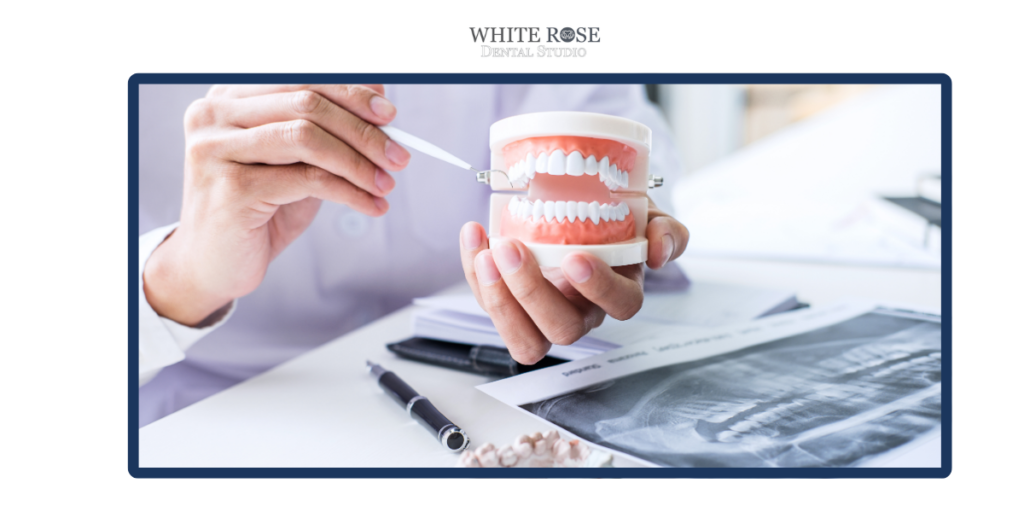 You should call a dentist after dental trauma if a tooth is chipped, cracked, loose, pushed out of position, knocked out, or painful. Dental trauma can happen during sports, play, falls, workplace accidents, or car accidents. Even if the tooth looks normal, an injury may affect the root, gum tissue, bite, or surrounding teeth. Call a dentist if: A tooth is loose A tooth is chipped or cracked A tooth has moved position The gums are bleeding around the tooth Your bite feels different The jaw feels sore A child has injured a tooth You are unsure whether the teeth were affected A dental exam can help determine whether X-rays, repair, monitoring, or another treatment may be needed.
