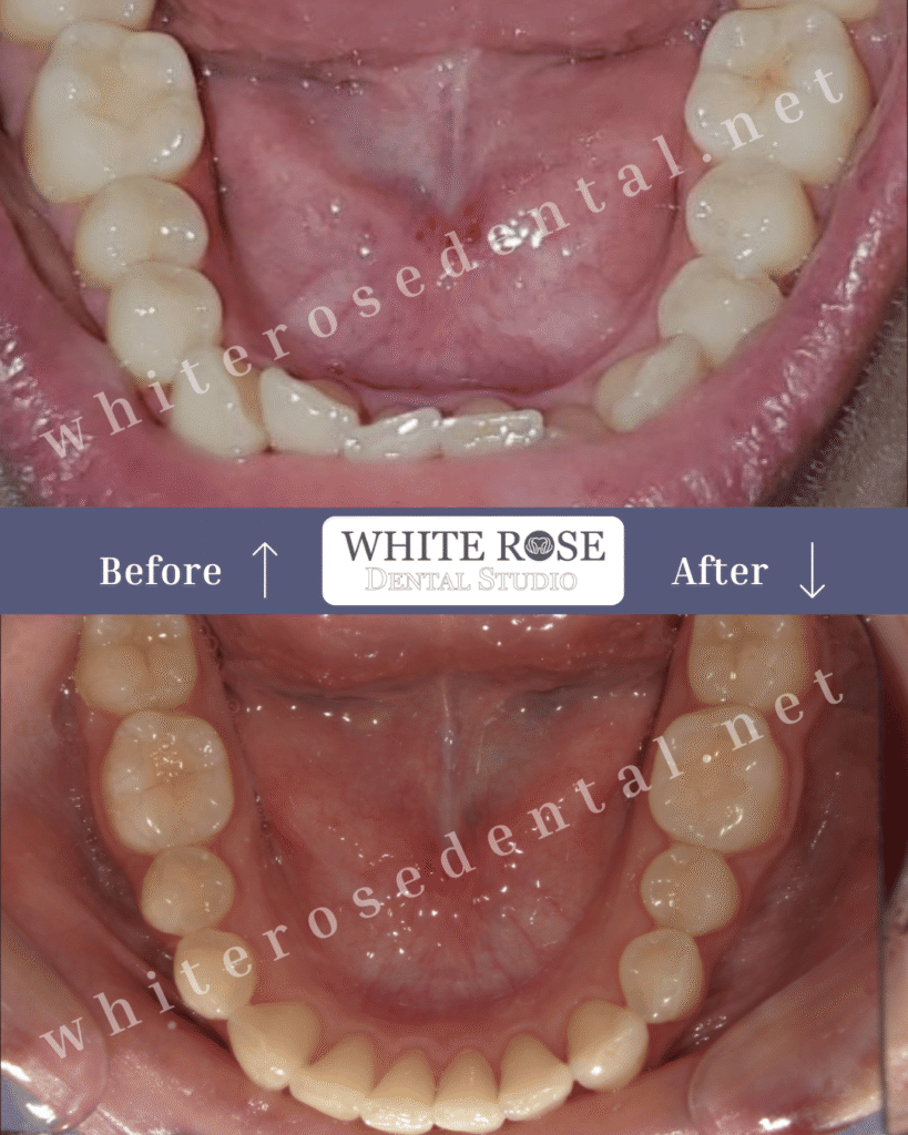 white-rose-dental-simile-transformation-9