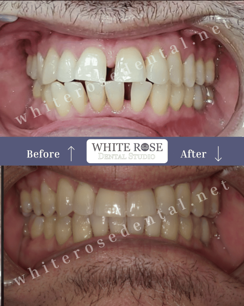 white-rose-dental-smile-transformation-10
