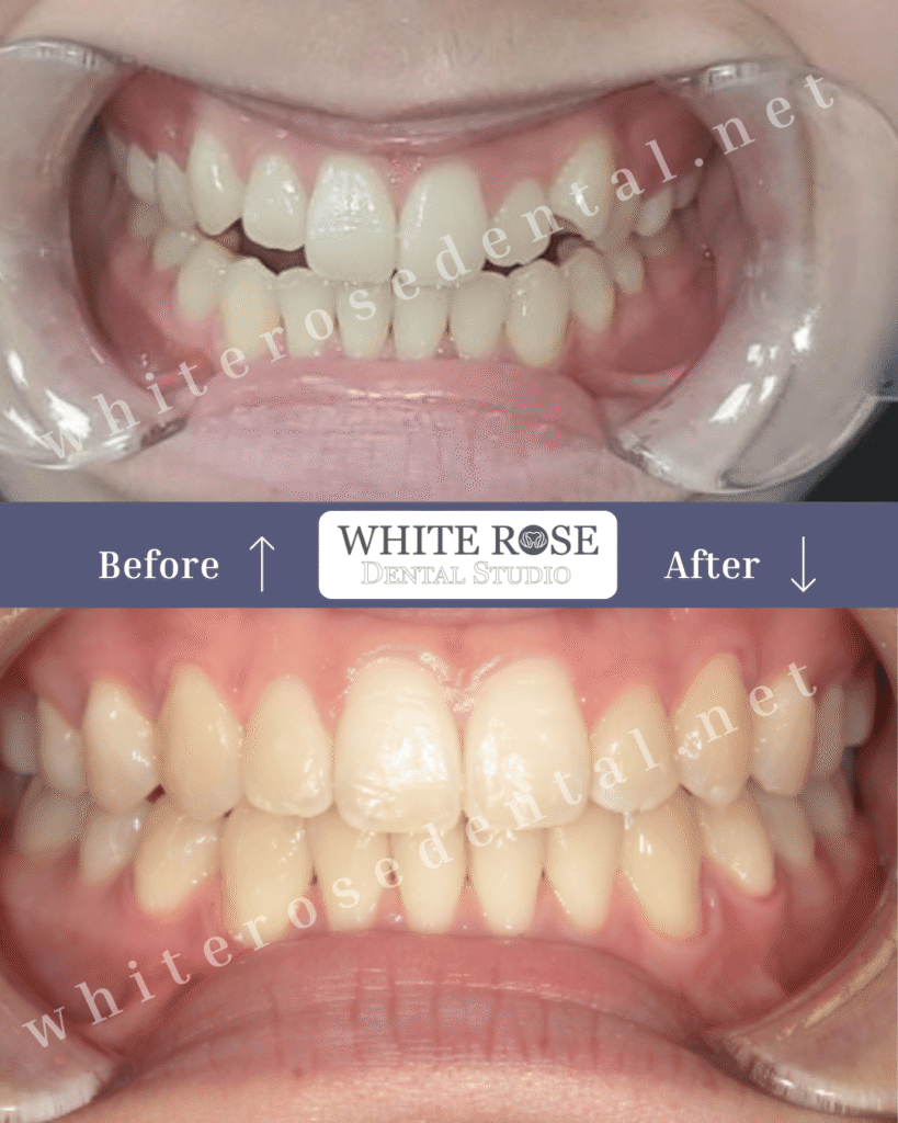 white-rose-dental-smile-transformation-11