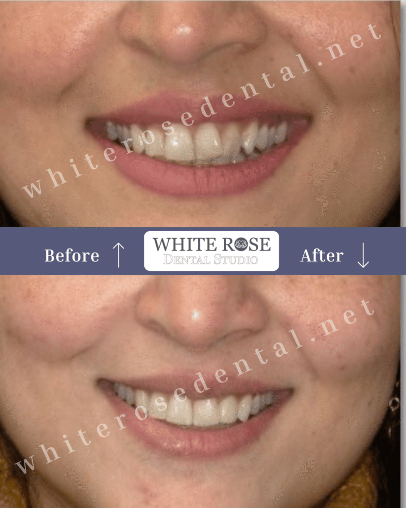 white-rose-dental-smile-transformation-14