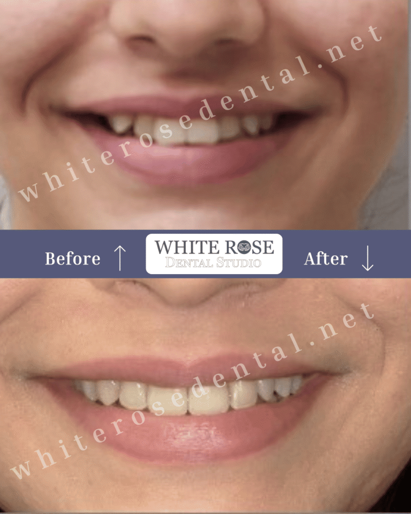 white-rose-dental-smile-transformation-16